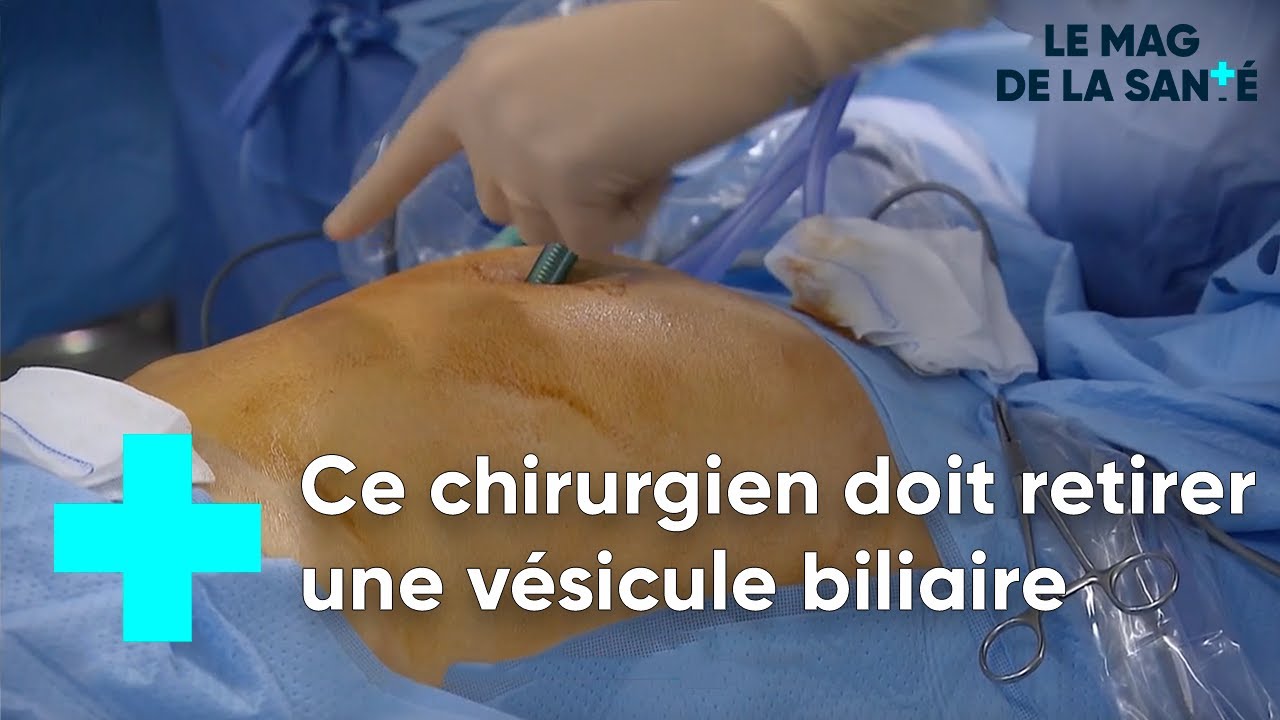 Quand il faut retirer la vésicule biliaire la cholécystectomie