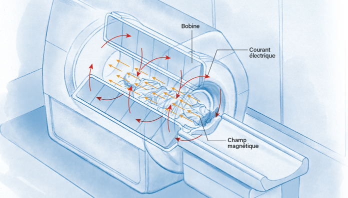 Comment-fonctionne-lIRM